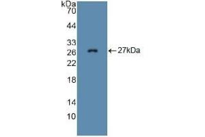 Detection of Recombinant FBN1, Mouse using Polyclonal Antibody to Fibrillin 1 (FBN1) (Fibrillin 1 anticorps  (AA 959-1145))