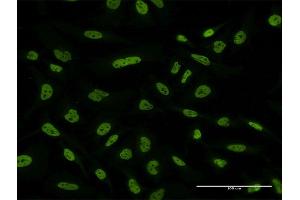 Immunofluorescence of monoclonal antibody to FUBP1 on HeLa cell. (FUBP1 anticorps  (AA 27-136))