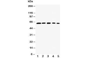 Western blot testing of RelB antibody and Lane 1:  rat testis;  2: (h) HeLa;  3: (m) NIH3T3;  4: (h) Raji;  5: (m) HEPA cell lysate. (RELB anticorps  (AA 393-413))