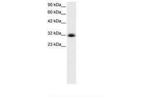Image no. 1 for anti-Retina and Anterior Neural Fold Homeobox (RAX) (N-Term) antibody (ABIN6735790) (RAX anticorps  (N-Term))