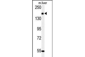 Western blot analysis of KI Antibody (C-term) (ABIN651358 and ABIN2840200) in mouse liver tissue lysates (35 μg/lane). (CCDC180 anticorps  (C-Term))