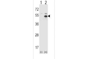 Western blot analysis of STAM using rabbit polyclonal STAM Antibody (P341) using 293 cell lysates (2 ug/lane) either nontransfected (Lane 1) or transiently transfected (Lane 2) with the STAM gene. (STAM anticorps  (C-Term))