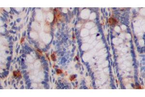 Detection of 5-HT in Rat Colon Tissue using Polyclonal Antibody to 5-Hydroxytryptamine (5-HT) (Serotonin anticorps)