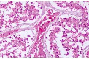 Anti-PTPRE antibody IHC staining of human testis. (PTPRE anticorps  (Cytoplasmic Domain))