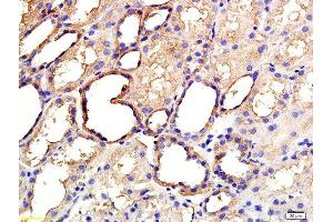 Formalin-fixed and paraffin embedded human kidney labeled with Anti ANGPTL3/ANG5 Polyclonal Antibody, Unconjugated  at 1:200 followed by conjugation to the secondary antibody and DAB staining (ANGPTL3 anticorps  (AA 21-120))