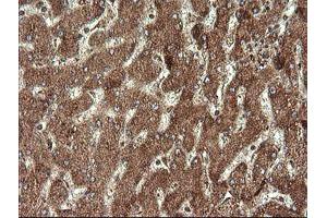 Image no. 2 for anti-serine/threonine Kinase 38 Like (STK38L) (AA 1-281) antibody (ABIN1490699)