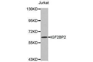 Western blot analysis of extracts of Jurkat cell line, using IGF2BP2 antibody. (IGF2BP2 anticorps  (C-Term))