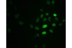 Immunofluorescence staining of Hela cells with ABIN7127742 at 1:100,counter-stained with DAPI. (Recombinant RPA2 anticorps  (pThr21))