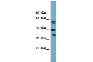 WB Suggested Anti-DHRS7B Antibody Titration:  0. (DHRS7B anticorps  (Middle Region))
