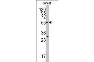 Western blot analysis of TERF1 polyclonal antibody  in Jurkat cell line lysates (35 ug/lane). (TRF1 anticorps  (C-Term))