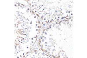 Immunohistochemistry of paraffin-embedded mouse testis using P-MYC-T58 antibody (ABIN3019538, ABIN3019539, ABIN3019540 and ABIN6225454) at dilution of 1:100 (40x lens). (c-MYC anticorps  (pThr58))