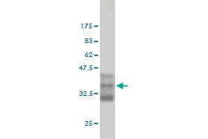 Western Blot detection against Immunogen (35.