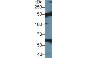 Detection of XDH in Bovine Liver lysate using Polyclonal Antibody to Xanthine Dehydrogenase (XDH) (XDH anticorps  (AA 2-219))