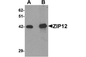 Western blot analysis of ZIP12 in HepG2 cell lysate with ZIP12 antibody at (A) 0. (SLC39A12 anticorps  (N-Term))