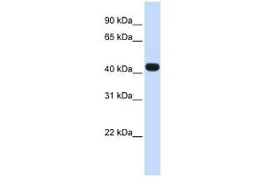 HS3ST3B1 antibody used at 1 ug/ml to detect target protein. (HS3ST3B1 anticorps)