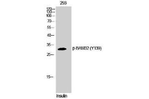 Western Blotting (WB) image for anti-Dual Adaptor of Phosphotyrosine and 3-phosphoinositides (DAPP1) (pTyr139) antibody (ABIN3179600) (DAPP1 anticorps  (pTyr139))