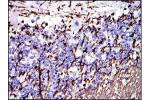 Immunohistochemical analysis of paraffin-embedded cerebellum tissues using MBP mouse mAb with DAB staining.