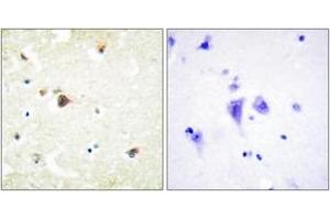 Immunohistochemistry analysis of paraffin-embedded human brain tissue, using TRIM3 Antibody. (TRIM3 anticorps  (AA 1-50))