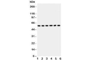 Western blot testing of AKT2 antibody and Lane 1:  HeLa;  2: PANC;  3: A549;  4: COLO320;  5: HT1080;  6: MCF-7 lysate (AKT2 anticorps  (C-Term))