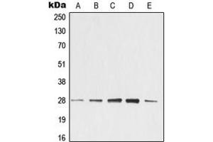Western blot analysis of 14-3-3 zeta expression in KNRK (A), NIH3T3 (B), C4 (C), EOC20 (D), CTLL2 (E) whole cell lysates. (14-3-3 zeta anticorps  (Center))