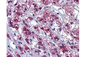 Immunohistochemistry (IHC) image for anti-GTP-Binding Protein 10 (GTPBP10) (Middle Region) antibody (ABIN2773813)