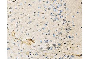 IHC analysis of Neurofibromin/NF1 using anti-Neurofibromin/NF1 antibody (ABIN7600196).
