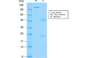 SDS-PAGE Analysis Purified CD43 Mouse Recombinant Monoclonal Antibody (rSPN/839).