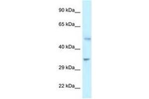Image no. 1 for anti-6-phosphofructo-2-Kinase/fructose-2,6-Biphosphatase 1 (PFKFB1) (C-Term) antibody (ABIN6747349) (PFKFB1 anticorps  (C-Term))