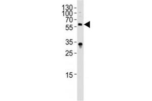 Western blot analysis of lysate from HepG2 cell line using IL1R1 antibody diluted at 1:1000.