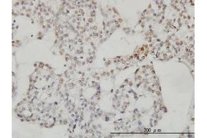 Image no. 3 for anti-Sestrin 2 (SESN2) (AA 1-481) antibody (ABIN466250) (Sestrin 2 anticorps  (AA 1-481))
