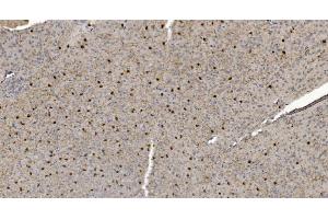 IHC analysis of Alpha B Crystallin/CRYAB using anti-Alpha B Crystallin/CRYAB antibody (ABIN7601209). (CRYAB anticorps  (AA 30-151))