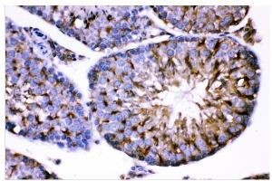 IHC analysis of AMHR2 using anti-AMHR2 antibody (ABIN4886456).