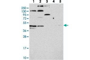 Western blot analysis of Lane 1: RT-4, Lane 2: U-251 MG, Lane 3: Human Plasma, Lane 4: Liver, Lane 5: Tonsil with C14orf80 polyclonal antibody  at 1:250-1:500 dilution. (C14ORF80 anticorps)