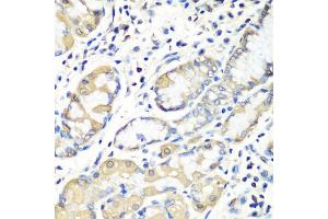 Immunohistochemistry of paraffin-embedded human stomach using EZR antibody (ABIN5974701) at dilution of 1/100 (40x lens). (Ezrin anticorps)