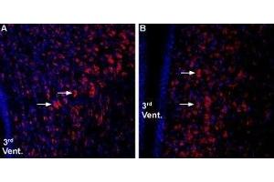 Expression of Ghrelin receptor in rat and mouse hypothalamus - Immunohistochemical staining of rat and mouse hypothalamic paraventricular nucleus (PVN) using Anti-Ghrelin Receptor (GHSR) (extracellular) Antibody (ABIN7043264, ABIN7044417 and ABIN7044418), (1:800).