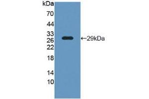 Figure. (LCP1 anticorps  (AA 5-233))