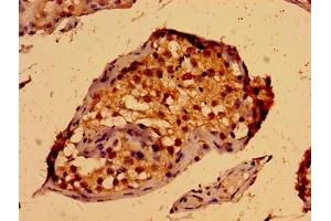 Immunohistochemistry of paraffin-embedded human testis tissue using ABIN7166440 at dilution of 1:100 (PORCN anticorps  (AA 269-332))