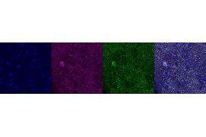 Immunohistochemistry (IHC) image for anti-ATP Synthase, H+ Transporting, Mitochondrial F1 Complex, alpha Subunit 1, Cardiac Muscle (ATP5A1) antibody (ABIN7456080)