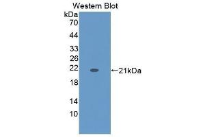 Western Blotting (WB) image for anti-Keratin 9 (KRT9) (AA 315-456) antibody (ABIN1864977) (KRT9 anticorps  (AA 315-456))