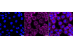 Immunocytochemical staining of HT- cells with PSMA2 antibody (ABIN7800960), 1:1,000). (Recombinant Proteasome 20S Subunit alpha 2 anticorps)