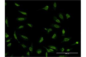 Immunofluorescence of monoclonal antibody to SFPQ on HeLa cell. (SFPQ anticorps  (AA 269-361))