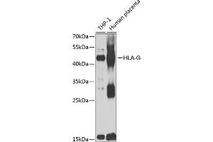 Western blot analysis of extracts of various cell lines, using HLA-G antibody  at 1:1000 dilution.