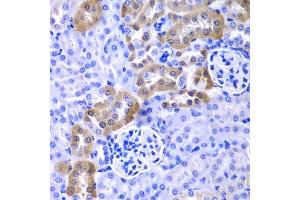 Immunohistochemistry of paraffin-embedded mouse kidney using LAMP1 antibody.