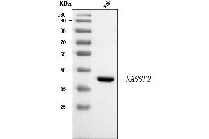 Western blot analysis of RASSF2 using anti-RASSF2 antibody (ABIN7599274).