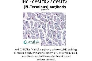 Image no. 3 for anti-Cysteinyl Leukotriene Receptor 2 (CYSLTR2) (N-Term) antibody (ABIN1733466)