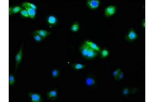 Immunofluorescence staining of HepG2 cells with ABIN7127382 at 1:60, counter-stained with DAPI.