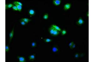 Immunofluorescence staining of HepG2 cells with ABIN7127382 at 1:60, counter-stained with DAPI. (Recombinant Caspase 9 anticorps)