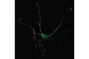 Indirect immunostaining of hippocampus neurons with anti-NBEA (dilution 1 : 1000; red) and mouse anti-PSD 95 (cat.