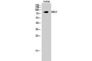 Western Blotting (WB) image for anti-MYST Histone Acetyltransferase 2 (MYST2) (Internal Region) antibody (ABIN3184974) (MYST2 anticorps  (Internal Region))