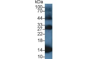 Western Blot; Sample: Rat Blood Cells lysate; Primary Ab: 1µg/ml Rabbit Anti-Equine HBb Antibody Second Ab: 0. (Hemoglobin Subunit beta anticorps  (AA 1-147))